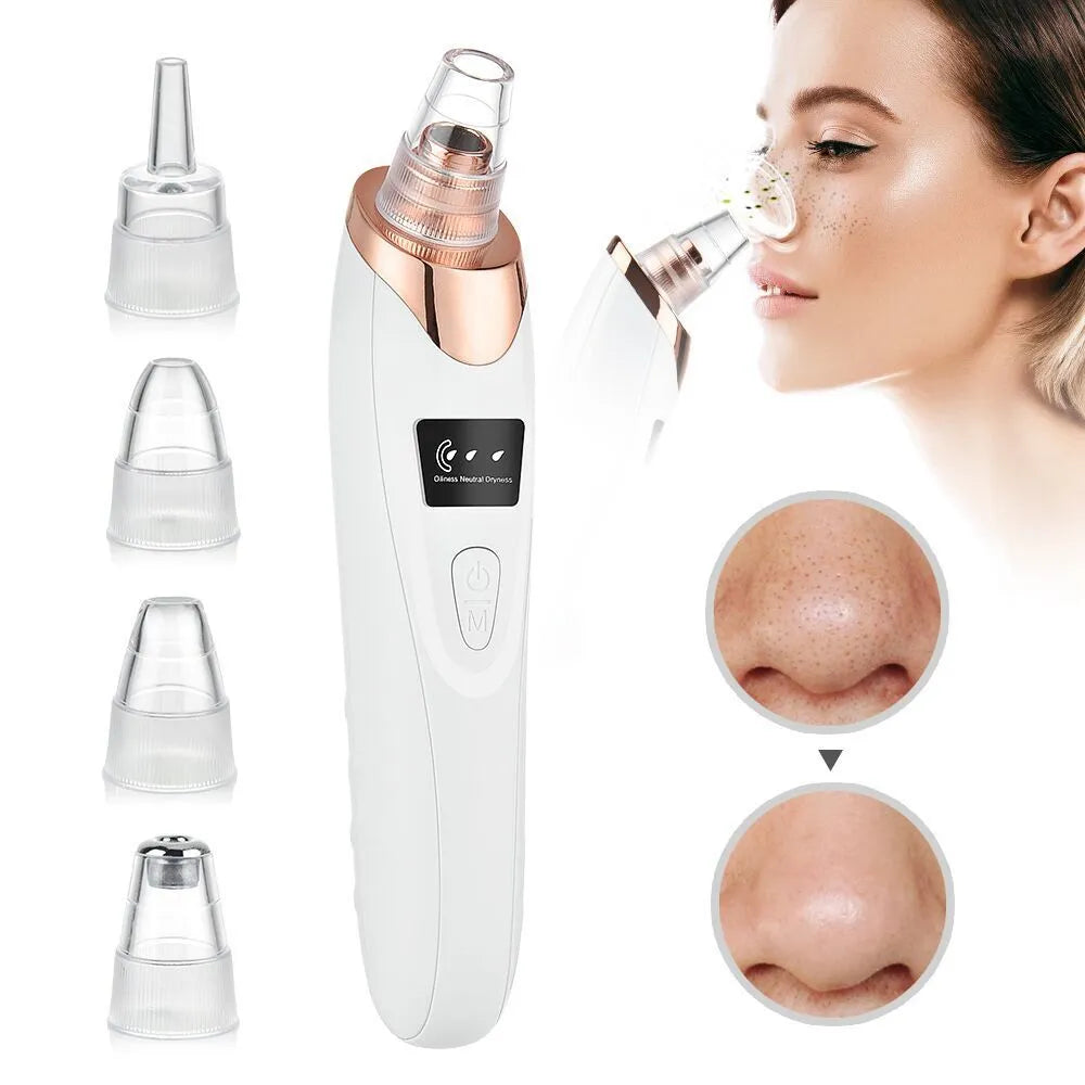 Evopure™ Blackhead Remover 75% Off
